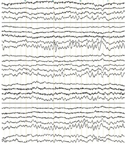 NeuralTechMe brain cycle diagram